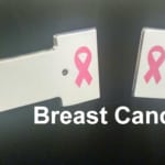 2_Breast_Cancer_20150701_191433